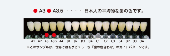 日本人の平均的な歯の色